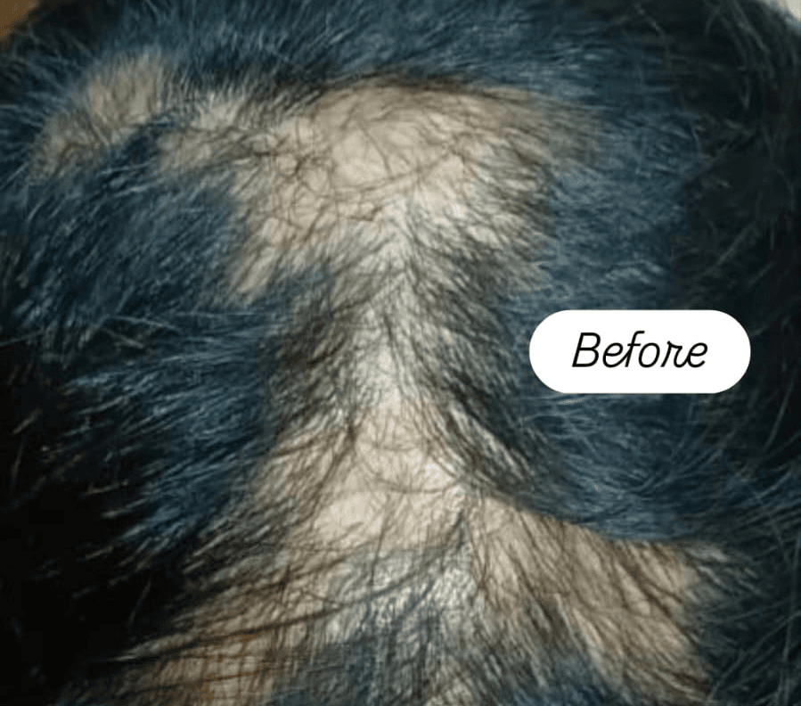 Skin Rejuvenation before treatment